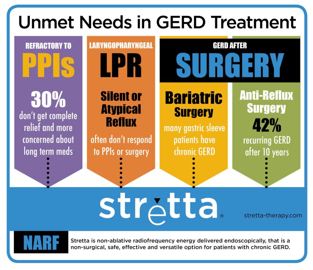 Stretta procedure - Georgia Surgicare